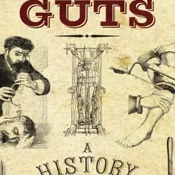 Blood and Guts: A History of Surgery