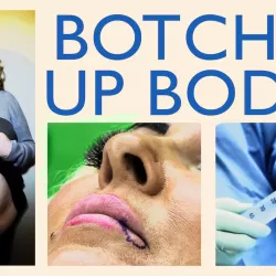 Botched Up Bodies